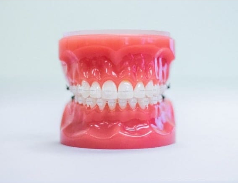 clear ceramic braces on plastic model