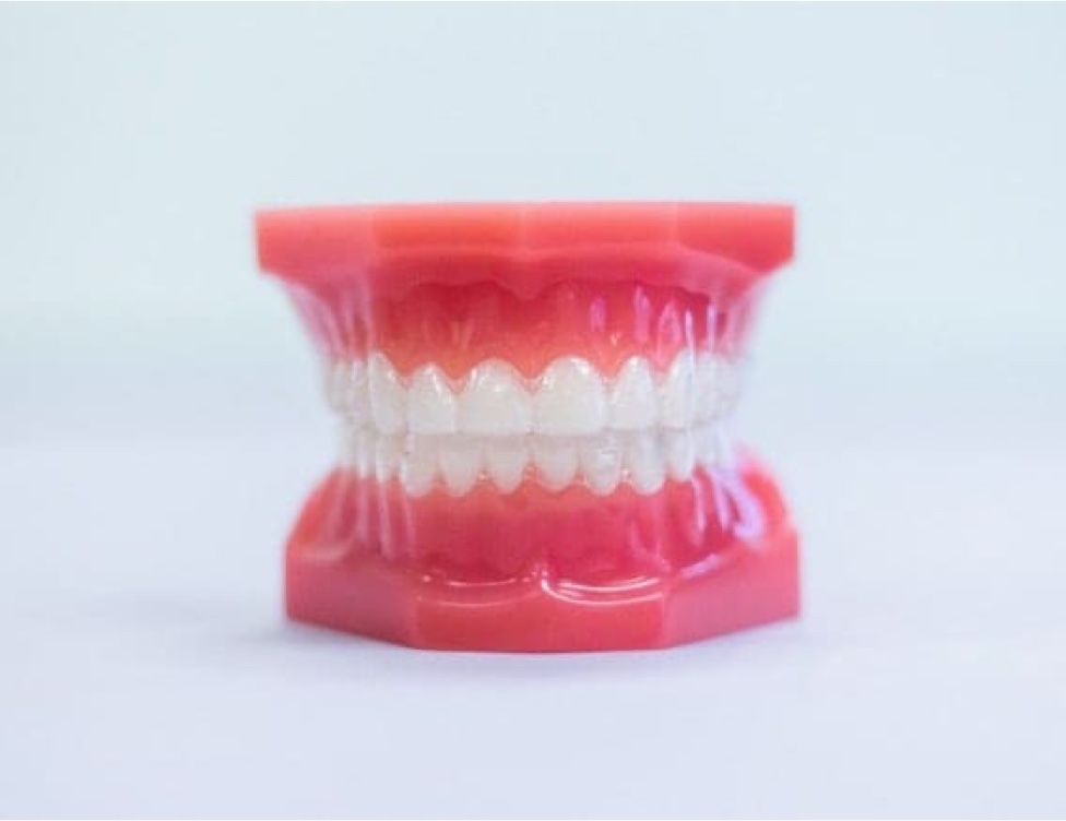 invisalign aligners on plastic model