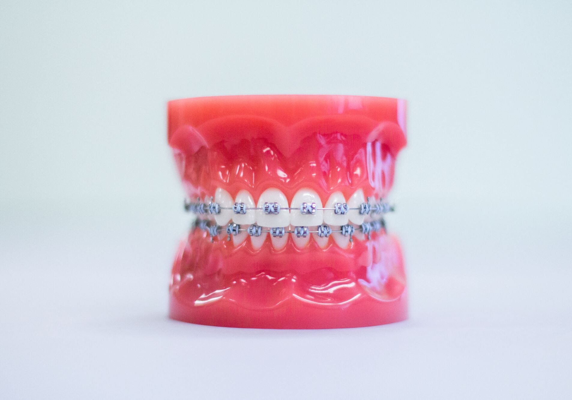 Beaumont Braces
