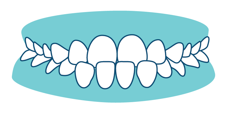 Teeth-Phase I Bite Problems-04